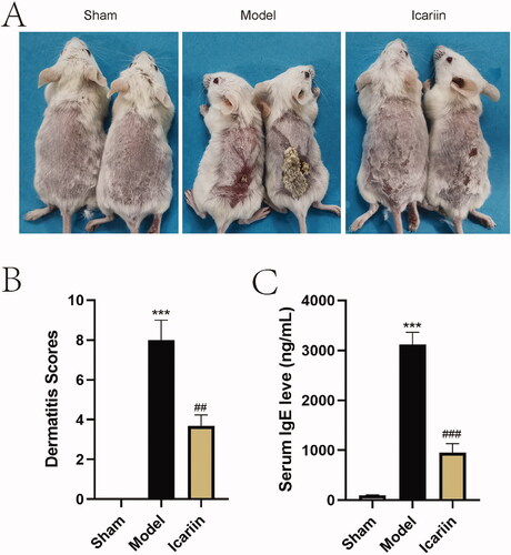 Figure 2. Icariin ameliorated AD-like symptoms in DNFB-stimulated mice. The AD mouse model was established by DNFB, and 5 weeks later, mice were administered with icariin for 2 weeks. (A) The change of skin was observed. (B) The dermatitis scores were evaluated according to four main characteristics of diseased skin: dryness/crusting, bleeding/erythema and erosion/peeling and oedema. (C) Serum IgE levels were determined by ELISA. ***p < 0.001 vs. sham; ##p < 0.01, ###p < 0.001 vs. model. n = 6.