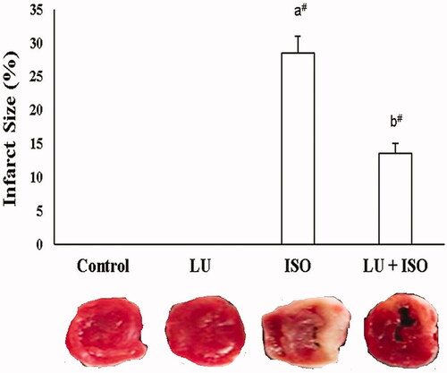 Figure 1. Effect of LU on cardiac infarct size. Values are explicated as the mean ± standard error of mean (SEM). The probability value (p-value; #p < 0.01, *p < 0.05): where ‘a’ indicates the significant difference between the ISO group and the Control group, while ‘b’ indicates the significant difference between LU + ISO group and ISO-induced groups. LU: lutein; ISO: isoproterenol.