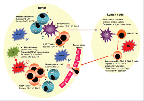 Figure 1. An immunosuppressive tumor and/or lymph node environment could be prognostic and impact responses to therapies in luminal B breast cancer. The figure depicts a tumor juxtaposed against a draining lymph node. The tumor milieu contains malignant cells which likely express checkpoint molecules such as PD-L1, and secrete suppressive molecules such as TGFβ and VEGF that limit T cell function and promote angiogenesis. Tumor-associated macrophages may initially represent pro-inflammatory, antitumor M1 macrophages (M1) that secrete TNF, IFNγ and other pro-inflammatory cytokines. However, in response to tumor-derived factors, M1 macrophages or newly recruited macrophages may polarize to anti-inflammatory, pro-tumor M2 macrophages (M2), or to an intermediate M3 macrophage (M3), both of which could express PD-L1 +/− Gal-9 or other checkpoint molecules, and secrete suppressive molecules such as TGFβ and IL-10, which together prevent effector CD8+ T cell function, particularly T cells expressing checkpoint molecules such as PD-1 and TIM-3. Myeloid-derived suppressor cells (MDSCs) augment the suppressive milieu by expressing and secreting similar immune suppressive molecules. Tumor-infiltrating dendritic cells (DCs) may take up whole tumor cells or tumor cell debris and traffic to lymph nodes. If, in response to the tumor microenvironment, DCs express checkpoint molecules such as PD-L1 and/or Gal-9, their ability to activate tumor-specific effector T cells is impaired, and they may instead induce Tregs. The presence of M2 macrophages in tumor-draining draining lymph nodes may further induce dysfunctional T cells expressing checkpoint inhibitors or Tregs.