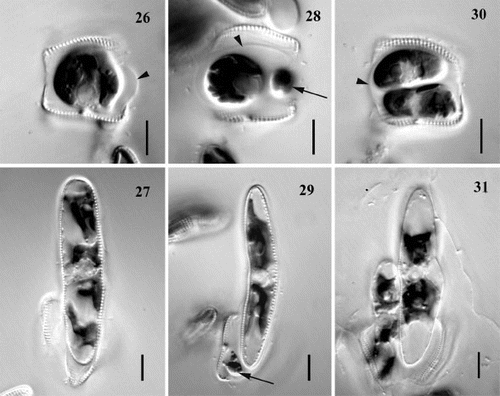 Figs 26 – 31. Variation in pattern of auxosporulation, clone C. A single cell produces: one auxospore (Figs 26, 27), one auxospore and small aborted cell (arrows) (Figs 28, 29), or two auxospores (Figs 30, 31). Note a mucilage sheath produced by auxosporulating cells (arrowheads). Scale bars represent 10 μm.