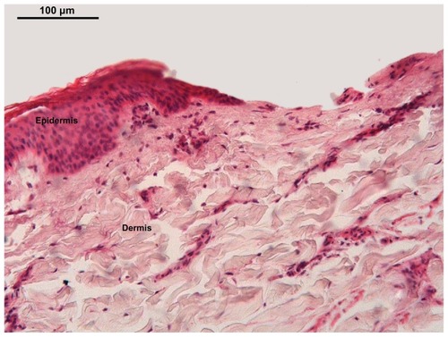 Figure 6 Light micrograph of the pig ear skin. The method totally removed the epidermis (E), remaining the dermis.Notes: Staining with hematoxylin and eosin. Scale bar = 20 μm.