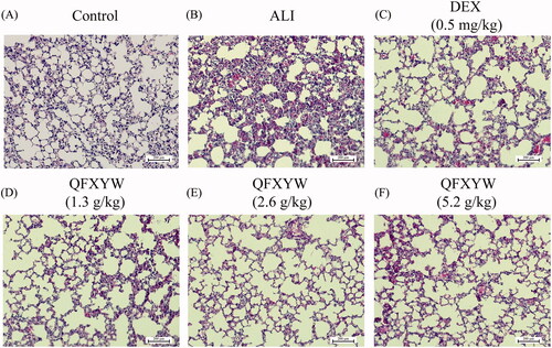 Figure 2. Histopathological changes of lung tissues of mice in each group (A) Control group; (B) ALI group; (C) DEX group; (D–F) QFXYW (1.3, 2.6, and 3.9 g/kg). ALI: acute lung injury; DEX: dexamethasone; QFXYW: Qingfei Xiaoyan Wan.