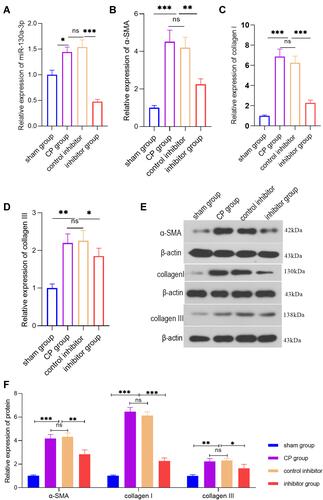 Figure 3 PCR or WB detection of the various indicators in pancreatic tissue from each group at the animal level. (A) PCR detection of the relative miR-130a-3p expression level in pancreatic tissue from each group. (B) PCR detection of the α-SMA expression level in pancreatic tissues from each group. (C) PCR detection of the collagen I expression level in pancreatic tissues from each group. (D) PCR detection of the collagen ш expression level in pancreatic tissues from each group. (E and F) WB detection of the α-SMA, collagen I, and collagen ш protein levels in pancreatic tissue (***p <0.001, **p <0.01, *p <0.05, NS denotes no significant difference).