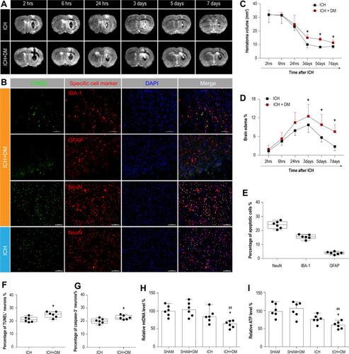 Figure 1 Hyperglycemia aggravated brain injury after ICH. (A) T2 weighted imaging was performed to detect the changing process of hematoma volume and brain edema from 2 hours to 7 days after ICH operation. (B) Hyperglycemia delayed the shrinking process of hematoma volume. (C) Hyperglycemia raised the peak of brain edema. (D) TUNEL staining was performed to explore the brain injury in cellular level. (E) Apoptosis of neuron and microglia were observed in perihematomal tissues after ICH. Hyperglycemia increased the percentage of (F) TUNEL positive and (G) cleaved Caspase 3 positive neurons. Hyperglycemia exacerbated this ICH-induced mitochondrial dysfunction, including (H) mtDNA and (I) ATP levels. Error bars represented mean ± standard deviation (SD). N = 6 per group. *P < 0.05 versus ICH group; ##P < 0.01 versus SHAM+DM group. Repeated measurement ANOVA with multivariate ANOVA followed by a Bonferroni test were performed for (B and C). Mann–Whitney U-tests were used for (F–I).