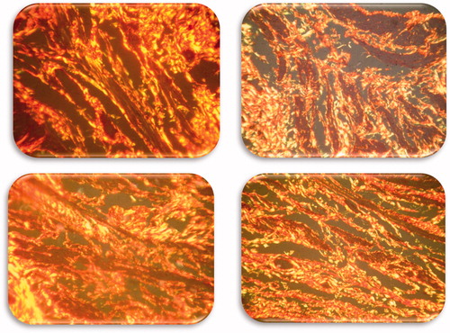 Figure 4. Picrosirius stained bladder wall of the testosterone group analyzed under polarized light microscopy (400×).