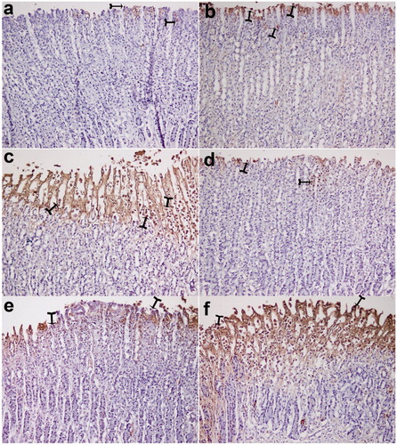 Figure 2. TUNEL assay. Nearly normal mucosa and minimal TUNEL positive cells were observed (a and b). TUNEL positive cells were observed in the intensive ethanol group (f), in the okra 100, Fam 20 and Que 75 and groups moderate amount of TUNEL-positive density was detected (c, d and e, respectively). (a) okra 500; (b) okra 250; (c) okra 100; (d) Fam 20; (e) Que 75 and (f) Ethanol groups. Arrows: TUNEL positive cells. Magnifications: 200×.