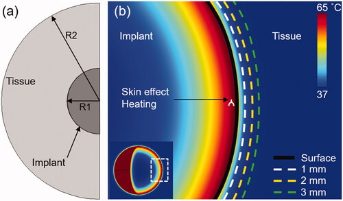 Figure 1. Computational model used in the study: (a) 2D axisymmetric model of a spherical metal implant and surrounding tissue used in this study (R1 = 4 cm, R2 = 12 cm). (b) The spatial temperature distribution through a cross-section of the implant after 10s of uniform skin-effect (0.9681 mm at 200 kHz) heating shows the conduction of heat inward into the metal implant and outward into tissue. The reduction of bacteria on the surface, and the tissue thermal dose at 1, 2 and 3 mm were quantified for different exposure conditions.