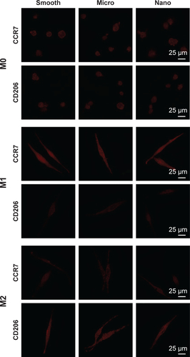 Figure S5 Protein expression of CCR7 (M1 marker) and CD206 (M2 marker) was measured using immunofluorescence staining after treatment with control, interferon gamma plus lipopolysaccharide or interleukin-4; CCR7 and CD206 (red).Abbreviations: CCR7, C–C chemokine receptor type 7; CD206, cluster of differentiation 206.