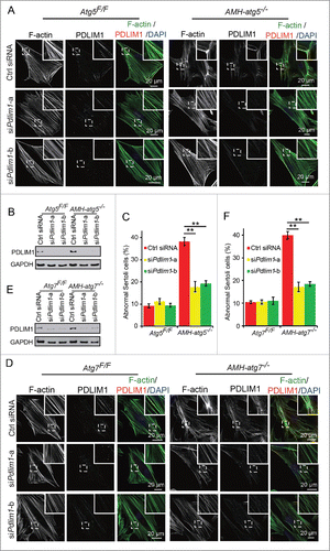 Figure 9. PDLIM1 might be the major substrate of autophagy to regulate cytoskeleton organization in Sertoli cells. (A and D) The disordered F-actin structures in autophagy-deficient Sertoli cells could be rescued by Pdlim1 knockdown. (A) Immunofluorescence analysis of phalloidin (green, labeled by FITC) and PDLIM1 (red) was performed in Atg5Flox/Flox(left panels) and AMH-atg5−/− (right panels) Sertoli cells after transfection with different siRNAs. (D) The same analysis as in (A) but conducted here with Atg7Flox/Flox(left panels) and AMH-atg7−/−Sertoli cells (right panels). Nuclei were stained with DAPI (blue). Ctrl siRNA indicates Sertoli cells transfected with nontargeting control siRNA. siPdlim1-a and siPdlim1-b indicate Sertoli cells transfected with siRNA duplexes targeting Pdlim1 in 2 different sites. (B and E) The Pdlim1 knockdown efficiency in Sertoli cells. (B) Immunoblotting analysis of PDLIM1 was performed in both Atg5Flox/Flox and AMH-atg5−/−Sertoli cells in (A). (E) Immunoblotting analysis of PDLIM1 in Atg7Flox/Floxand AMH-atg7−/−Sertoli cells in (D). GAPDH served as a loading control. (C and F) Quantification of the disorganized F-actin structures. (C) The percentage of Sertoli cells with severely accumulated foci was decreased after knockdown of Pdlim1 in autophagy-deficient Sertoli cells. In AMH-atg5−/−Sertoli cells, 38.16 ± 1.85% of Sertoli cells transfected with nontargeting control siRNA duplexes (red columns) had perturbed F-actin structures, whereas 17.81 ± 2.30% (siPdlim1-a, yellow columns) and 19.34 ± 1.17% (siPdlim1-b, green columns) of Sertoli cells transfected with siRNA duplexes targeting Pdlim1 had disordered structures.(ctrl siRNA 9.10 ± 0.91%, siPdlim1-a 11.14 ± 1.29%, siPdlim1-b 9.31 ± 0.84% in Atg5Flox/Flox Sertoli cells) (F) In AMH-atg7−/−Sertoli cells, 39.89 ± 1.76% of Sertoli cells had perturbed F-actin structures in the control group (red columns), whereas 17.19 ± 2.04% (siPdlim1-a, yellow columns) and 18.50 ± 1.07% (siPdlim1-b, green columns) of Sertoli cells had disordered F-actin structures after knocking down Pdlim1 by specific targeting with siRNA duplexes. (ctrl siRNA 10.49 ± 0.63%, siPdlim1-a 10.55 ± 0.92%, siPdlim1-b 11.07 ± 1.61% in Atg7Flox/Flox Sertoli cells).