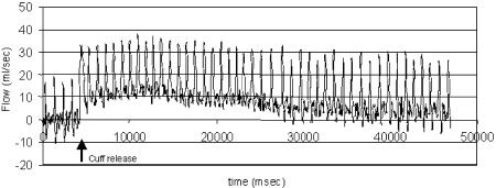 Figure 2. Representative hyperemic flow curve in a healthy volunteer. Vacuum-driven release of cuff causes immediate increase in flow.