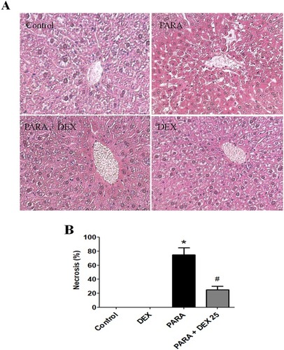 Figure 3 Effects of DEX on PARA-induced liver toxicity-related histology. (A) Mice were administered saline (control), PARA (300 mg/kg) alone, DEX (25 μg/kg) 30 mins after PARA injection, or DEX (25 μg/kg) alone, and were sacrificed 16 hrs later for H&E staining (200x). Typical images were chosen from each group. (B) Cell necrosis was evaluated in livers from controls, DEX alone, PARA (300 mg/kg) alone, and DEX (25 μg/kg) 30 mins after PARA injection. The percent of necrosis was estimated by evaluating the number of microscopic fields with necrosis compared to the entire histologic section. Data represent means ± SE of n=6 animals per group; *p < 0.05 vs. control; #p < 0.05 vs. PARA alone.