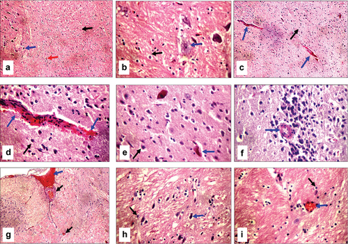 Figure 9. Histopathologic features of brain sections stained with hematoxylin and eosin; (a) Sham operated group shows average astrocytes (black arrow), average neurons (blue arrow), and average blood vessels (red arrow) in fibrillary background (X200). (b) Higher magnification of the previous section shows average astrocytes (black arrow) with average neurons (blue arrow) in a fibrillary background (X400). (c) Bile duct-ligated (BDL) group shows average astrocytes in a fibrillary background (black arrow), and ruptured small blood vessels (blue arrows) (X200). (d) Higher magnification of the previous section shows average astrocytes in a fibrillary background (black arrow), and ruptured small blood vessels with extravasated red cells (blue arrows) (X400). (e) Another view of the BDL group shows average astrocytes in the fibrillary background (black arrow), and scattered degenerated neurons (blue arrow) (X400). (f) Another section of the BDL group shows thick-walled blood vessels in the hippocampus (blue arrow) (X400). (g) Bile duct ligated-selenium (BDL-Se) group shows less dilated congested blood vessels (black arrows) and dilated congested blood sinusoids (blue arrow) (X200). (h) BDL-Se group shows average astrocytes in the fibrillary background (black arrow) and average neurons (blue arrow) (X400). (i) BDL-Se group shows average astrocytes in the fibrillary background (black arrow) and less congested blood vessels (blue arrow) (X400).