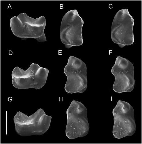 Figure 2. A–C, Distoechurus jeanesorum sp. nov., QM F61140 holotype, Lm1. A, buccal view. B, C, occlusal stereopair. D–I, Distoechurus georginae sp. nov. D–F, QM F61145, Rm1. D, buccal view; E, F, occlusal stereopair. G–I, QM F61144 holotype, Rm1. G, buccal view; H, I, occlusal stereopair. Scale = 1 mm. [169 mm width].