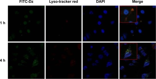 Figure 4 CLSM images of the intracellular distribution of N-Ac-l-Leu-PEI/Dz nanocomplex for 1 hour and 4 hours.Notes: Blue, nuclei (DAPI); red, lysosome (Lyso-Tracker Red); green, DNAzyme (FITC-labeled). The boxed areas represent the enlarged cells to show the intracelluar distribution of nanocomplex.Abbreviations: CLSM, confocal laser scanning microscopy; N-Ac-l-Leu-PEI, N-acetyl-l-leucine-polyethylenimine; h, hour; DAPI, 4,6-diamidino-2-phenylindole; FITC, fluorescein isothiocyanate.