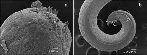 Figure 4. Acanthocheilus rotundatus adult male, scanning electron micrographs: (a) detail of anterior end; (b) caudal end
