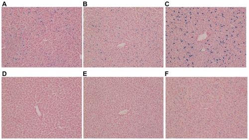 Figure 1 Histological study of mouse liver specimens stained with Prussian blue (magnification ×200). (A), (B), (C): 30 minutes, 1, and 3 hours, respectively, after intraperitoneal (IP) injection of ultrasmall superparamagnetic iron oxide. (D), (E), (F): 30 minutes, 1, and 3 hours, respectively, after IP injection of small superparamagnetic iron oxide.