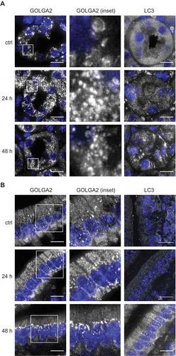 Figure 4. HCQ alters the Golgi organization in kidney and intestinal cells of treated mice. C57BL/6JOlaHsd mice were injected daily with 60 mg/kg HCQ or with saline solution (ctrl) and sacrificed 24 h after the first injection (24 h) or 24 h after the second injection (48 h). Representative images of kidney cells (A) and intestinal cells (B) stained for GOLGA2 and LC3 from one mouse are shown (images from the second and third mouse of the same groups are displayed in Figure S6). Scale bars: 10 µm.