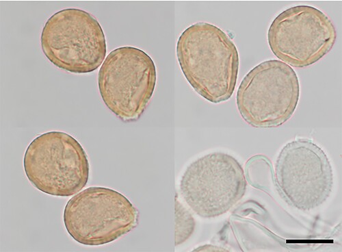 Figure 14. Puccinia lachnagrostidis on Lachnagrostis billardierei: Urediniospores and paraphyses. Scale bar = 20 µm.