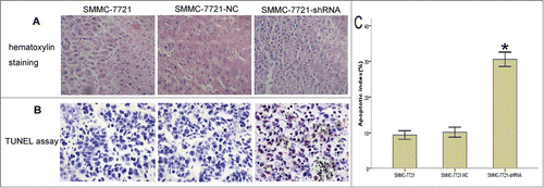 Figure 3. Effects of Gli2 silencing on sensitivity of SMMC-7721 cells to TRAIL-induced apoptosis in vivo. After the mice were sacrificed, apoptosis was detected in tumor tissues using HE staining and TUNEL assay. (A) HE staining, magnification × 400. Apoptotic cell showed karyopyknosis and red staining of the cytoplasm. (B) TUNEL assay, magnification × 400. The nucleis of apoptotic cells were stained brown. (C) Bar chart of the apoptosis index (AI). The results are representative of sections obtained from 5 tumors in the same group, scale bar: 100 μm (A and B). *P < 0.05 compared with control (C).