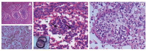 Figure 1 Common histopathological findings of footpad tissue from mice stimulated at two sites; H&E. Focal lesions that were granuloma-like (A, 40x) and rich in fungal cells (B, 400x) observed 30 days post-infection. (C) After 60 days of infection, lesions presented low numbers of sclerotic-like cells (arrows; 200x and insert 1000x), regions rich in histiocytes*H (clear cytoplasms due to cell-cell junctions) and organized focal lesions surrounded by fibroblasts*F (cells with elongated nucleus). (D) 90 days post-infection, high numbers of polymorphonuclear cells(*) were verified in focal lesions without the presence of fungal cells.