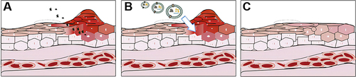 Figure 3 PDVLNs can repair inflammation induced by bacteria and viruses. Legend (A) shows bacterial and viral invasion of cells, Legend (B) shows PDVLNs effecting on the cell surface, and Legend (C) shows anti-inflammatory repair after PDVLNs effecting on the cell surface.