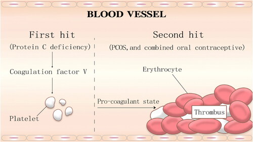 Figure 4. Schematic diagram of the possible mechanism of thrombus in this case.