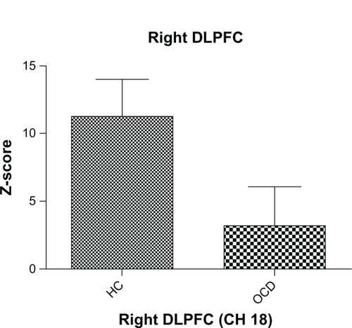 Figure 3 Mean z-score during the verbal fluency task in the right dorsolateral prefrontal cortex (channel 18). The vertical bars represent the standard error. The oxygenated hemoglobin concentration in patients with obsessive-compulsive disorder at the right dorsolateral prefrontal cortex was significantly smaller than that in controls (P < 0.05).