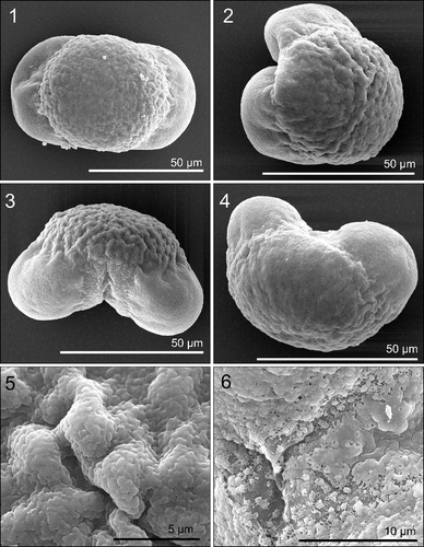 Plate 4. Scanning electron microscopy (SEM) images of treated Cedrus atlantica pollen grains. Scale indicated on each image. Figures 1–2. Polar view from the top and side. Figures 3–4. Equatorial view. Figure 5. Close-up of corpus surface. Figure 6. Close-up of leptoma.