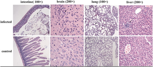 Fig. 3 Light microscopy observations of rat tissues infected with bat-SL-CoVs: Sectioned brain, intestine, lung and liver tissues were sampled from rats infected with bat-SL-CoV ZC45