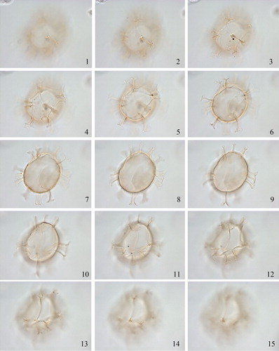 Plate 7. 1–15. Holotype of Spiniferites ristingensis Head Citation2007 in ventral view at high to low focus. Central body length 42 µm. Slide provided by MJH, photographed by MJH.