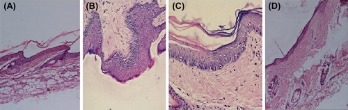 Figure 4. Skin histology: (A) Control group, (B) Skin treated with MXT, (C) Skin treated with Trioxysalen, and (D) Skin treated with MXT and trioxysalen.