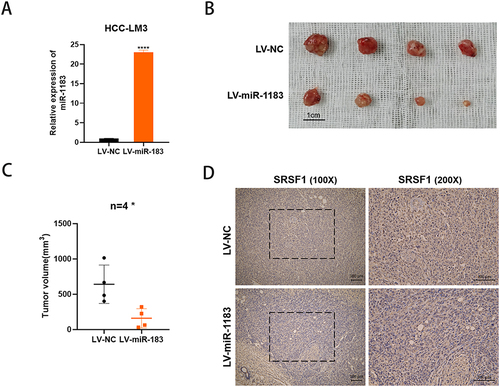 Figure 6 Overexpression of miR-1183 inhibits HCC growth in vivo. (A) Overexpression of miR-1183 in HCC-LM3 cells was verified by qRT-PCR. (B) Representative images of xenograft tumors in nude mice. (C) The tumor volume of xenografts. (D) Immunohistochemistry (IHC) staining of SRSF1 in xenografts. *p < 0.05; ****p < 0.0001.