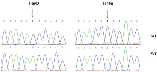Figure 2 Identification of tRNAGlu A14693G and A14696G mutations by direct sequencing.