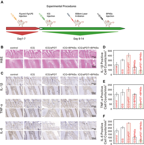 Figure 6 In vivo assessments of BPNSs on the suppression of aPDT-aggravated periodontal inflammation. An analysis of the pathological aspects of periodontal inflammation model triggered by P. g-LPS and P. g. (A) A flowchart of the in vivo tests, which includes medication administration and animal modeling. (B) H&E and (C) IHC assessment of periodontal tissues following treatments. (D–F) The equivalent measurement of positive cells with (D) IL-1β, (E) TNF-α and (F) IL-6 immunostaining.