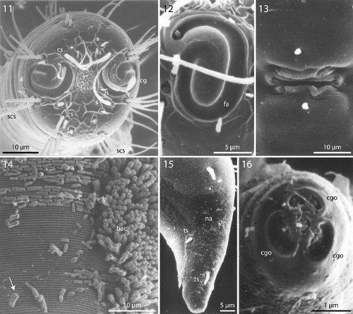 Figs. 11–16. Robbea hypermnestra sp. nov. Female. 11. Head, in face view; 12. Amphidial fovea; 13. Vulva; 14. Annulation and bacterial coat in midbody region; 15. Tip of tail, non-striated portion; 16. Openings of the caudal glands. SEM.