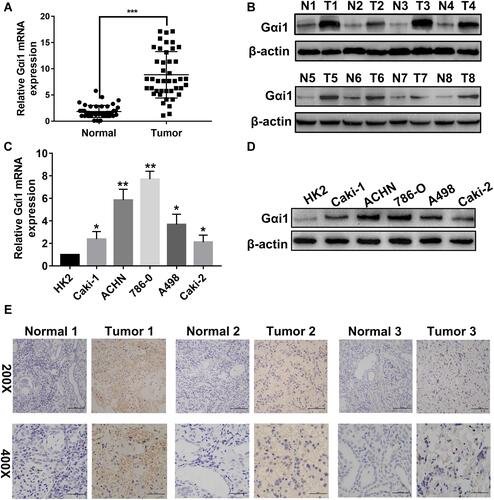 Figure 1 Gαi1 expression is upregulated in RCC tissues and RCC cell lines. The expression of Gαi1 mRNA (A) in RCC tumor tissues with different tumor stages and normal tissues was detected by by qRT-PCR. The relative quantification was calculated by the 2−ΔΔCt method and normalized based on GAPDH. Expression level of Gαi1 protein (B) in RCC tissues and adjacent normal tissues. Gαi1 mRNA (C) and protein expression (D) in RCC cell lines and normal epithelium cell of renal tubule HK2. IHC analysis (E) of Gαi1 in RCC and adjacent normal tissues. Results were presented as mean ± SD. *P<0.05, **P<0.01, ***P<0.001.