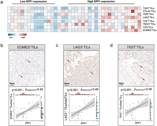 Figure 5. SPP1 is related with T cell exhaustion in RCC.