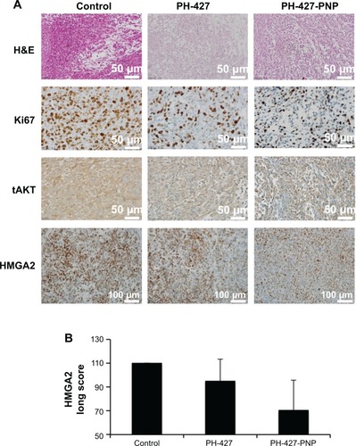 Figure 6 (A) In vivo inhibition of tumor proliferation and AKT. Representative staining is shown for H&E, Ki-67, tAKT, and high-mobility group AT-hook 2 (HMGA2) of control, PH-427-treated, and PH-427-PNP-treated mice (PH-427-PNP, PNP loaded with the PH-427 chemotherapeutic agent). (B) Long scores for HMGA2 staining for control, PH-427, and PH-427-PNP. The values are the means and the error bars are the standard errors (n=2). All images were acquired with 40× magnification.Abbreviations: H&E, hematoxylin and eosin; PNP, poly(lactic-co-glycolic acid) polymeric nanoparticles; tAKT, total AKT.