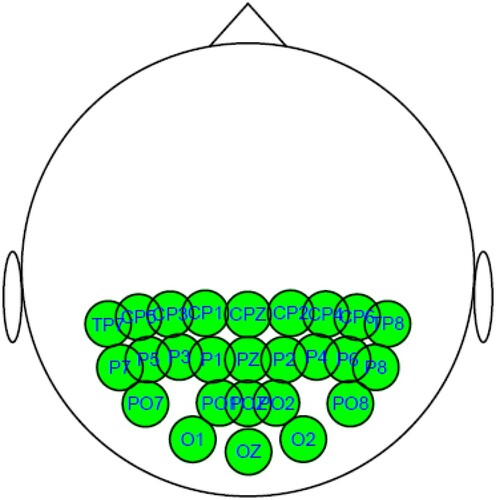 Figure 1. Presentation of recording on EEG voltages.