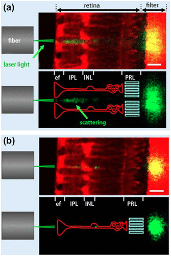 Figure 28. Light-guiding capability of Müller cells. The laser light beam (green) from a glass fibre illuminates the retinal slice attached to a filter membrane. Müller cells and the membrane are stained by a red fluorescent dye. A laser scanning microscope records this fluorescence, as well as the scattering of the laser light (green; yellow if overlaid by red-fluorescent structures). (Bottom): for better visualization, the scattering of laser light is combined with a schematic drawing of Müller cells (red) and the photoreceptor layer (PRL, lime-green). (a) Laser passing in between 2 Müller cells causes scattering within the retina and produces wide spread patch of light at the filter. (b) Laser entering directly through the Müller cell endfoot causes a small intense spot. Scale bars 20 μm. Source: Reichenbach et al. 2014, reproduced with permission from e-Neuroforum.