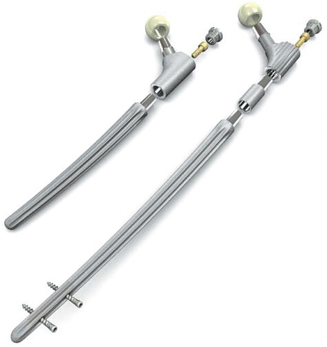 Figure 1. The MRP-TITAN curved stem, shown with and without proximal extension and distal locking bolts.