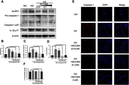 Figure 5 MCC950 inhibited HG-induced NLRP3 inflammasome activation in mesangial cells.