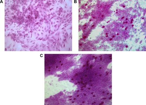 Figure 2 Conjunctival cytology analysis (stained with periodic acid–Schiff, 40×).