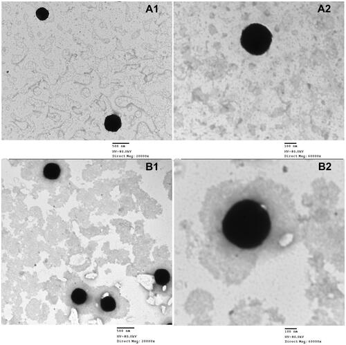 Figure 3. Transmission electron micrographs of (A) cubosomal dispersion OE-NC3 at different magnification powers (A1, A2) and (B) cubosomal dispersion OE-NC4 at different magnification powers (B1, B2).