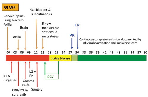 Figure 1. Delayed, durable, complete response of metastatic melanoma.