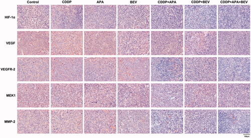 Figure 7. Representative images showing immunostaining for HIF-1α, VEGF, VEGFR-2, MEK1 and MMP-2 in the tumour tissues of the indicated groups (original magnification, ×400). APA: apatinib; BEV: bevacizumab; CDDP: cisplatin; HIF-1α: hypoxia-inducible factor-1α; MEK1: MAPK/ERK kinase 1; MMP-2: matrix metalloproteinase 2; VEGF: vascular endothelial growth factor; VEGFR-2: vascular endothelial growth factor receptor 2.