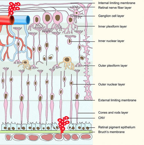 Figure 1 Composition of the retina and ocular neovascularization. Retinal vessels grow through the retinal nerve epithelium to form retinal neovascularization. The choriocapillaris enter under the RPE through the ruptured Bruch’s membrane to form CNV.