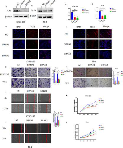 Figure 2. TCF3 promotes proliferation, migration, and invasion of ESCC cells. a-d. KYSE-150 and TE-1 have decreased TCF3 protein expression after siRnas targeting TCF3 could significantly knockdown the expression of TCF3 protein and TCF3 mRNA. E-F. The fluorescence intensity of TCF3 was reduced in KYSE-150 and TE-1 after si-TCF3 was transfected. G-H. The migration and invasion abilities of KYSE-150 and TE-1 were decreased when TCF3 was knocked down. I&J. The wound healing rates of KYSE-150 and TE-1 were decreased when TCF3 was knocked down. K&L. Cell proliferation is affected by KYSE-150 and TE-1 after the siRNA knockdown of TCF3.