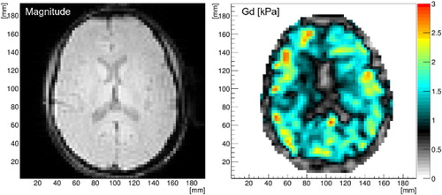 Figure 2. Example of MRE scan’s results: magnitude and reconstructed Gd values of a healthy volunteer, 50 Hz, 3x3x3 mm voxels, central slice.