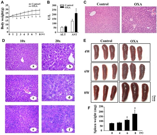 Figure 1 OXA-induced liver injury and splenomegaly in mice. (A) Time course study of body weight after treatment with i.p. oxaliplatin (OXA). (B) Serum ALT and AST levels one week after the final OXA dose. (C) Histological examination of liver tissues after treatment with OXA for eight weeks (H&E staining, original magnification: 100×). (D) Sinusoidal dilation (a, b), steatosis (c, d), and inflammatory cell infiltration (e, f) were detected in the liver sections of the OXA-treated group (H&E staining, original magnification: 200×). (E and F) Images of the spleen (E) and average spleen weights (F) of wild-type mice or those treated with OXA for four, six, and eight weeks. The edge of the spleen had a saw-tooth profile after treatment with OXA for four weeks, splenomegaly and the saw-tooth edge were observed at six weeks, and splenomegaly was detected after eight weeks. The results are shown as the mean ± SD for each group. *P<0.05 vs control group.